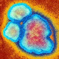 Measles virus particles, TEM. © Science Photo Library