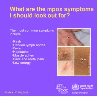Social media cards: Mpox - what you need to know