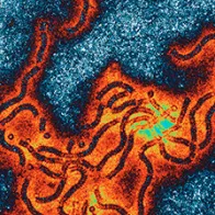 Mumps virus. © Science Photo Library