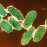 Yersinia pestis (plague) bacteria. © Science Photo Library