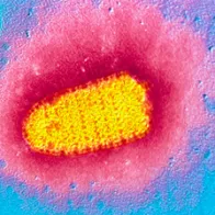 TEM of rabies virus. © Science Photo Library