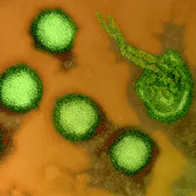 Rift Valley fever virus, TEM. © Science Photo Library