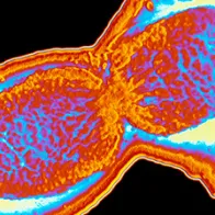 Shigella flexneri bacterium. © Science Photo Library