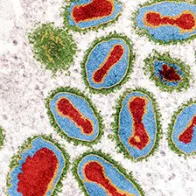 Smallpox viruses. © Science Photo Library