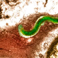 Syphilis bacterium (Treponema pallidum). © Science Photo Library