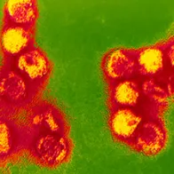 Coloured TEM of tick-borne encephalitis virus. © Science Photo Library