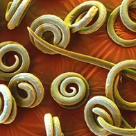 Colour SEM of Trichinella spiralis roundworms. © Science Photo Library