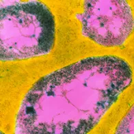 Francisella tularensis bacteria. © Science Photo Library