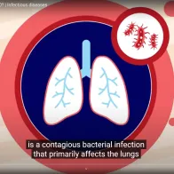 Cover of the animation: Can we end TB by 2023?