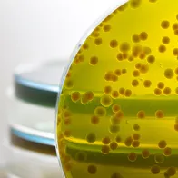 Image of shigella test