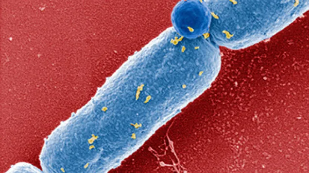 Anthrax bacteria. © Science Photo Library