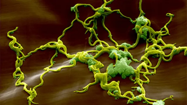 Lyme disease bacteria, Borrelia. © Science Photo Library