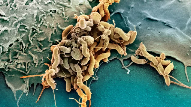 Helicobacter pylori bacteria, SEM. © Science Photo Library