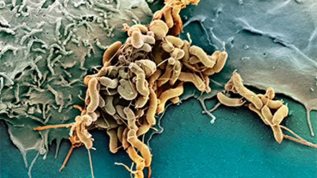 Helicobacter pylori bacteria, SEM. © Science Photo Library