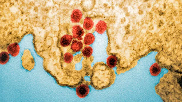 Chikungunya virus particles. © Science Photo Library