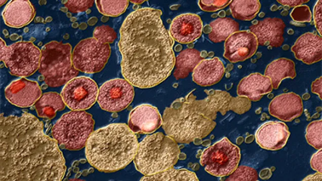 Chlamydia trachomatis bacteria, TEM. © Science Photo Library