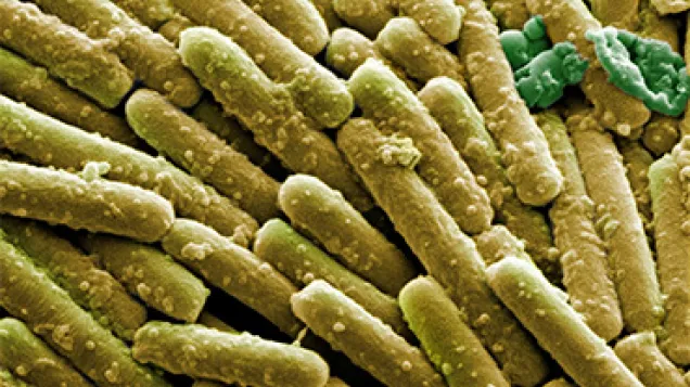 Clostridium difficile bacteria, SEM. © Science Photo Library