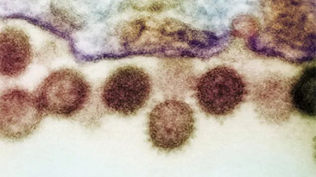 Crimean-Congo haemorrhagic fever virus. © Science Photo Library