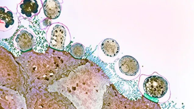 Cryptosporidiosis, TEM. © Science Photo Library