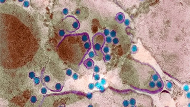 Dengue fever virus particles, TEM. © Science Photo Library