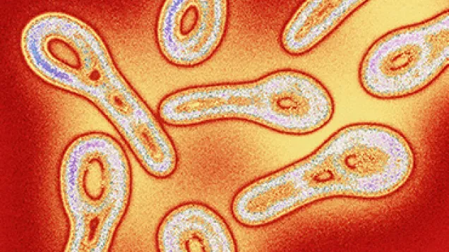 Coloured TEM of Corynebacterium bacteria. © Science Photo Library