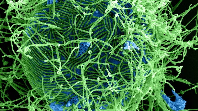 Ebola Virus Particles 4 by NIAID.jpg