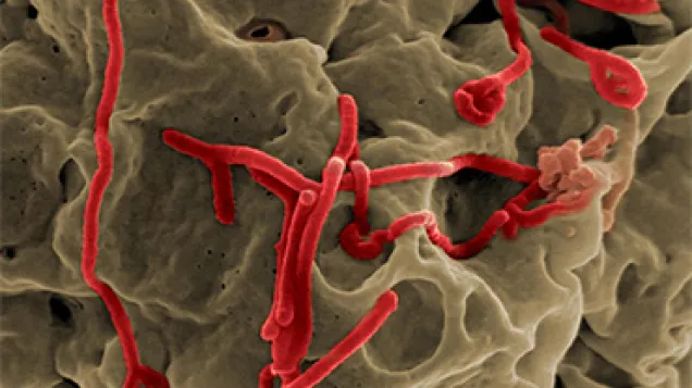 Scanning electron micrograph of Ebola virus budding from the surface of a Vero cell (African green monkey kidney epithelial cell line). Credit: NIAID