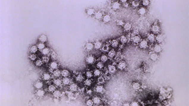 Morphologic traits of the Coxsackie B4 virus virions. Credit: CDC