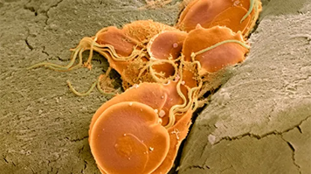 Giardia lamblia protozoa, SEM. © Science Photo Library