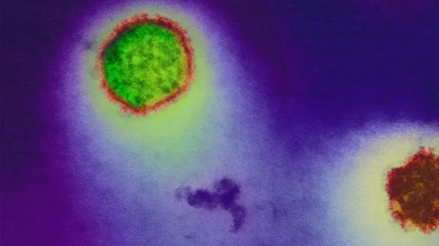 Hantavirus. © Science Photo Library