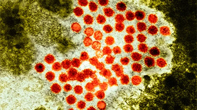 Hepatitis A virus particles, TEM. © Science Photo Library