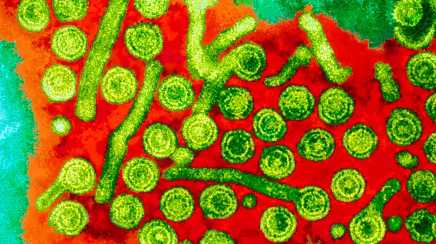 Hepatitis B viruses, TEM. © Science Photo Library