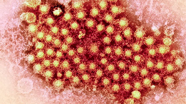 Hepatitis virus particles, TEM. © Science Photo Library