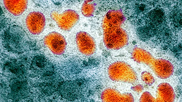 H5N1 avian influenza virus particles, TEM. © Science Photo Library