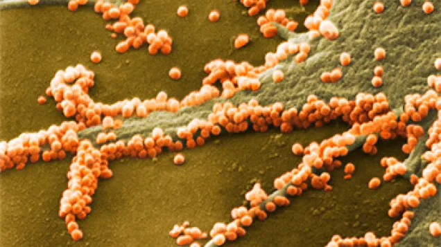 H1N1 flu virus particles, SEM. © Science Photo Library