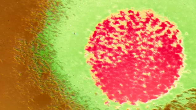 Coloured TEM of Lassa fever virus. © Science Photo Library