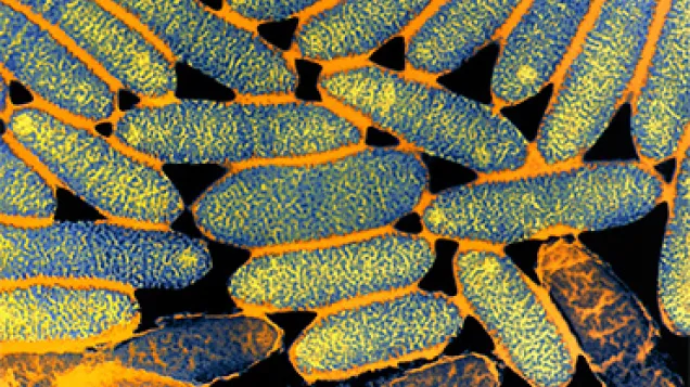 TEM of Legionella pneumophila bacteria. © Science Photo Library