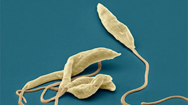 Leishmania parasites, SEM. © Science Photo Library