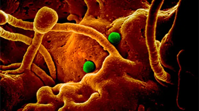 MERS-CoV particles on camel epithelial cells. Credit: NIAID