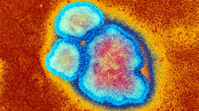 Measles virus particles, TEM. © Science Photo Library