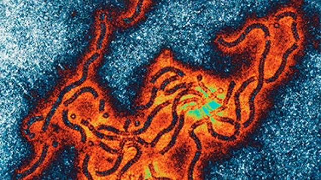 Mumps virus. © Science Photo Library