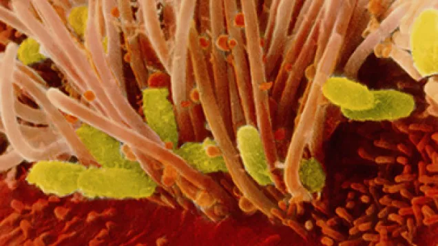 Bordetella pertussis bacteria in trachea. © Science Photo Library