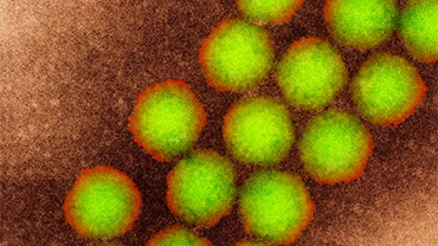 Poliovirus particles, TEM. © Science Photo Library