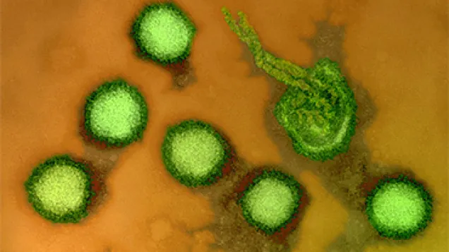 Rift Valley fever virus, TEM. © Science Photo Library