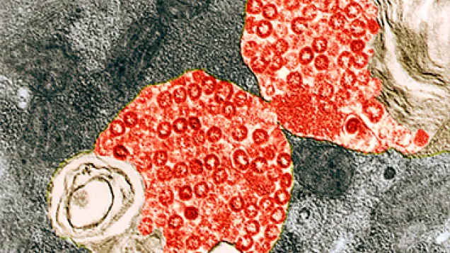 SARS virus particles, TEM. © Science Photo Library