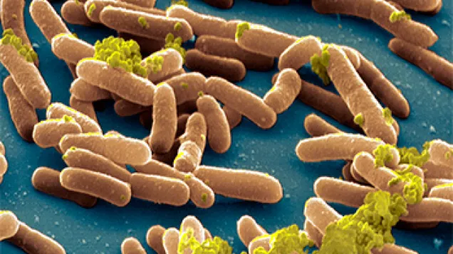Salmonella typhimurium bacteria. © Science Photo Library