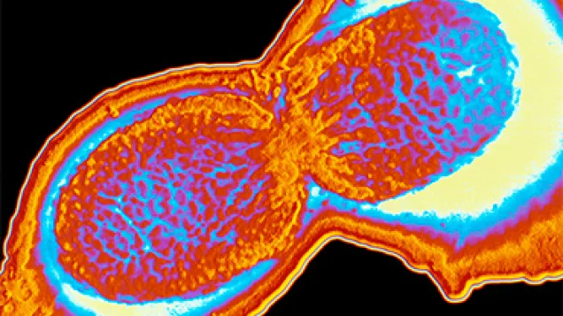 Shigella flexneri bacterium. © Science Photo Library