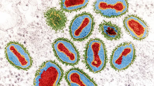 Smallpox viruses. © Science Photo Library