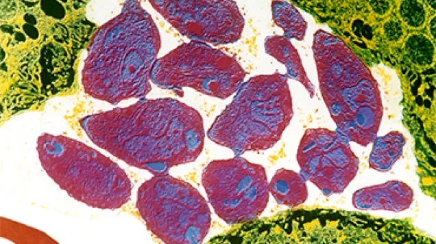 Toxoplasmosis. © Science Photo Library