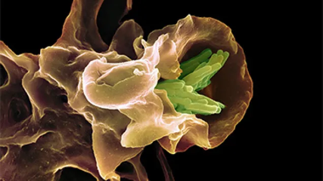 Macrophage engulfing TB bacteria, SEM. © Science Photo Library